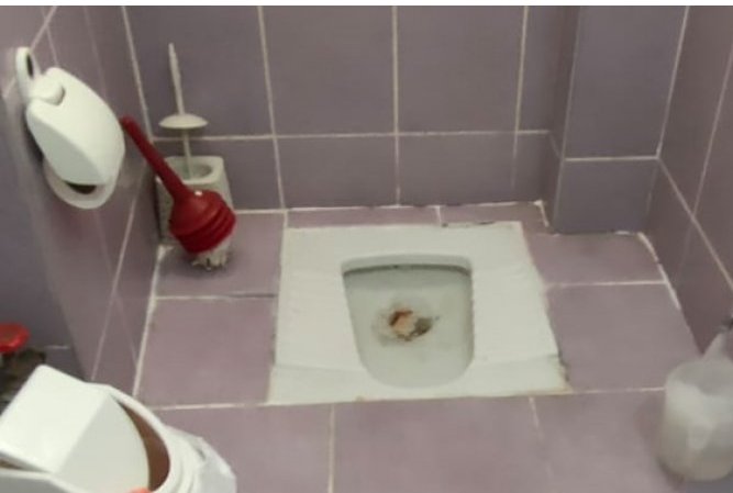 Tıkanıklık Nasıl Açılır?